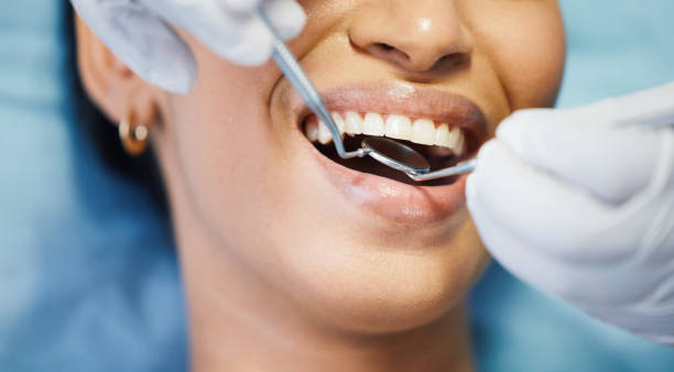 Best Emergency Denture Repair in Buies Creek, NC